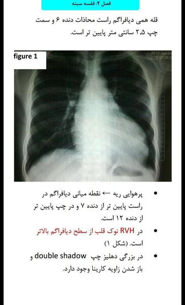 عکس پرهوایی ریه
