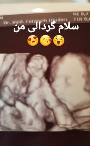 تبادل عکس نی نی سایت
