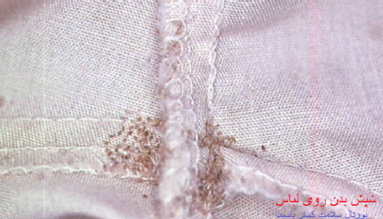 عکس شپش لباس