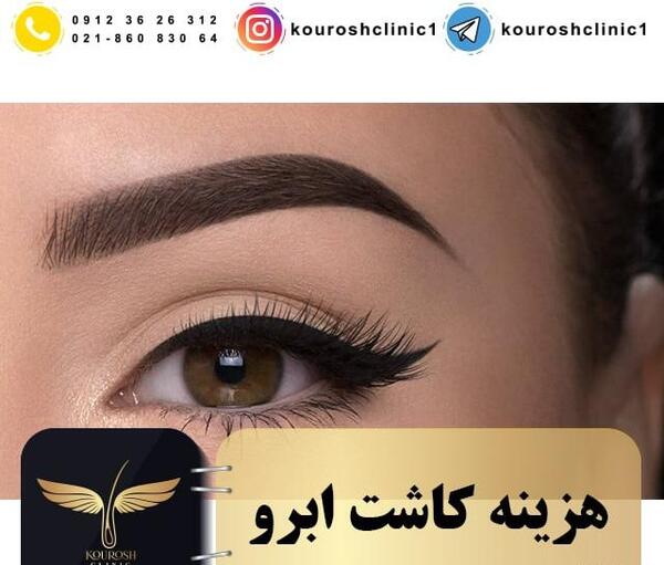 عکس جراحی کاشت ابرو