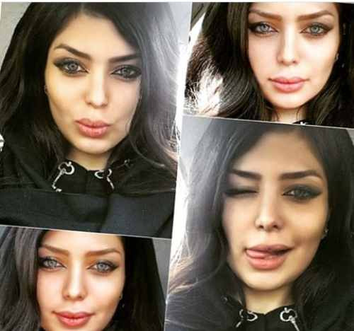 عکس قبل عمل نیلوفر بهبودی