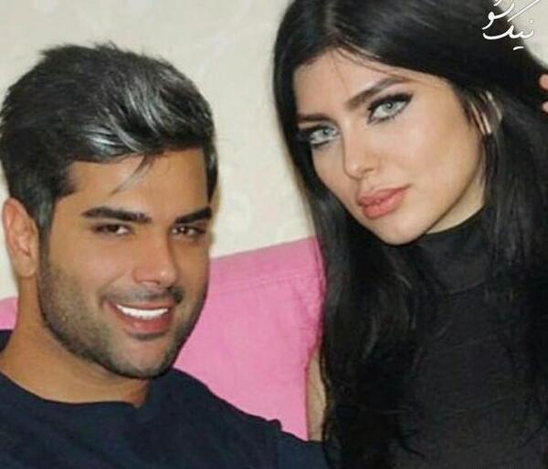 عکس قبل عمل نیلوفر بهبودی