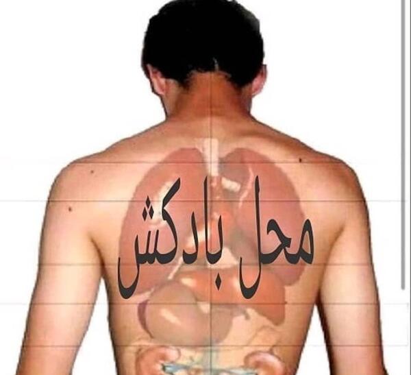 عکس بادکش گرم ریه