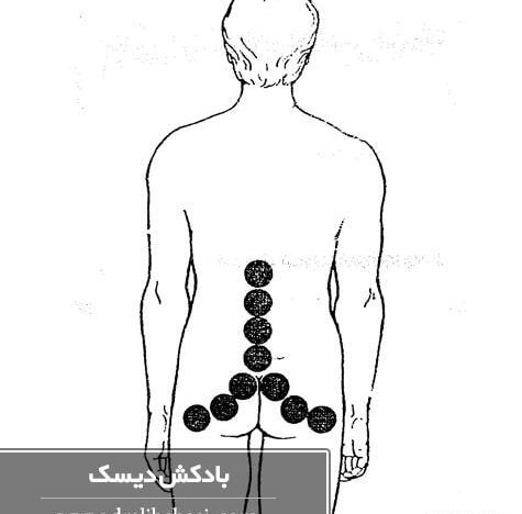 عکس بادکش گرم ریه