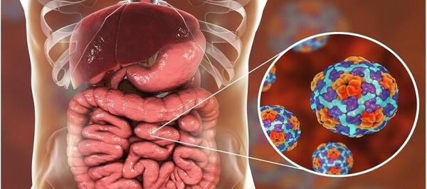 عکس ویروس معده
