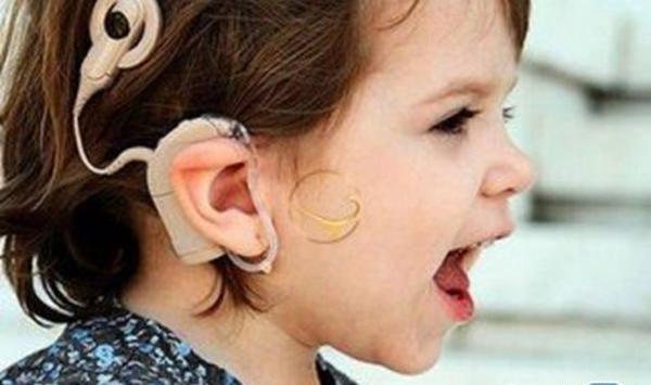 عکسهای کاشت حلزون شنوایی