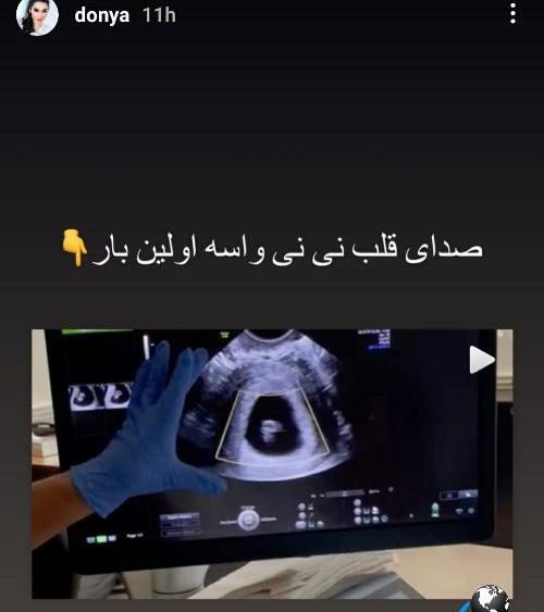 عکس بچه مهراد جم