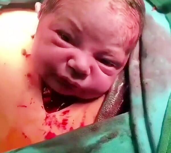 عکس بچه تو شکم