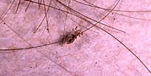 عکس جانور شپش