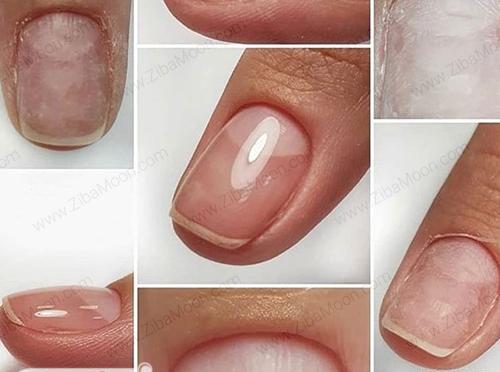 عکس ناخن لمینت