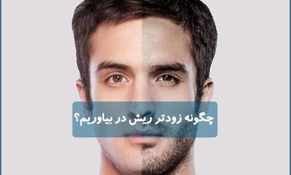 عکس ریش کم