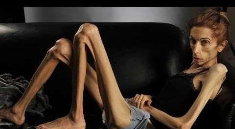 عکس آدم لاغر زشت