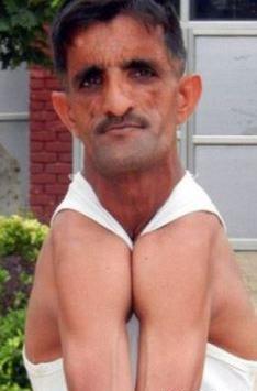 عکس آدم لاغر زشت