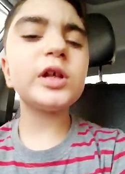 عکس پروف لب خونی