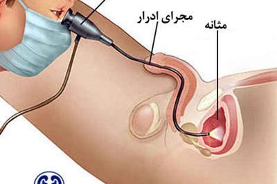 عکس مردی که دارد جیش می کند
