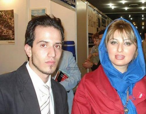 عکس قبل عمل نیوشا ضیغمی