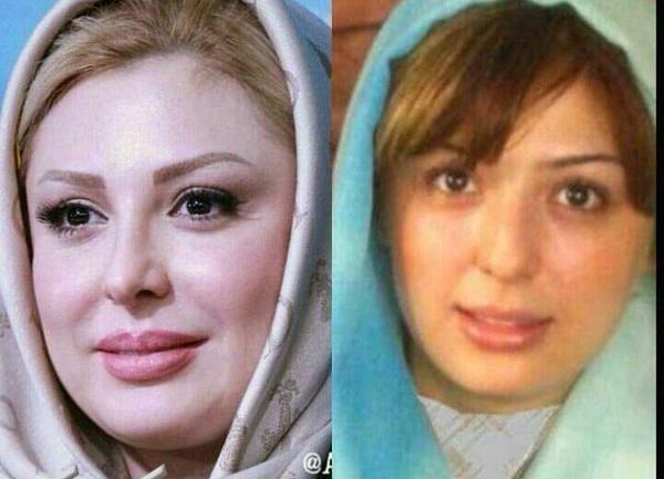 عکس قبل عمل نیوشا ضیغمی