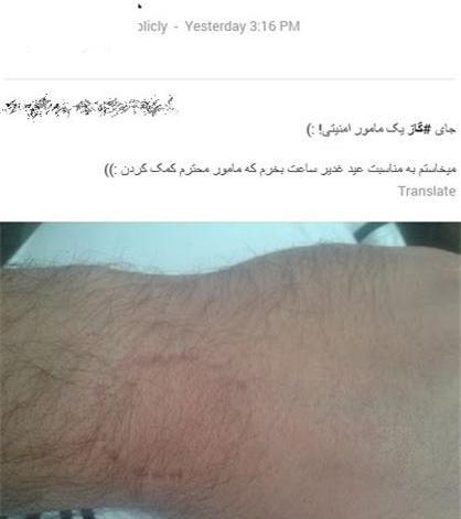 عکس عاشقانه گاز گرفتن