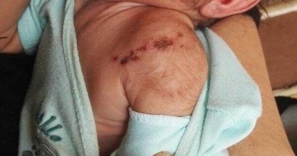 عکس عاشقانه گاز گرفتن