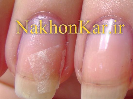عکس ناخن شکسته