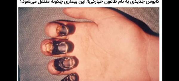 عکس ویروس طاعون
