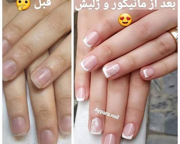 عکس ناخن قبل کاشت