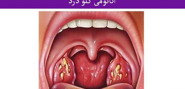 عکس داخل گلو