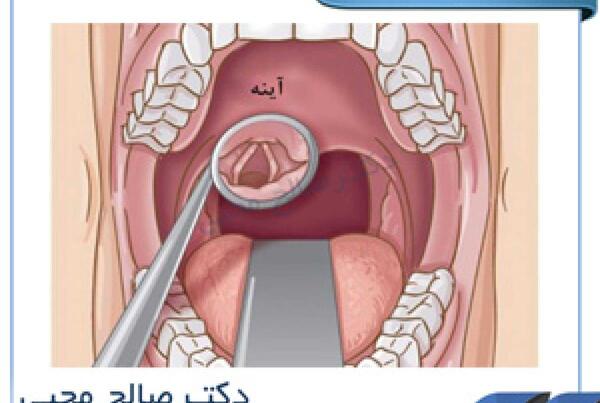 عکس داخل گلو