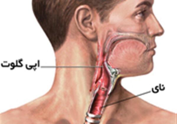 عکس داخل گلو