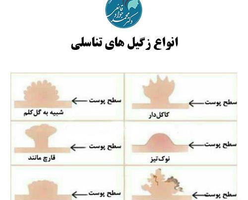 عکس ویروس تناسلی