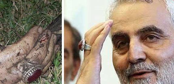 عکس واقعی جسد حاج قاسم سلیمانی