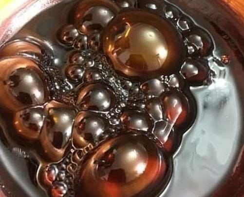 عکس ریه تریاکی