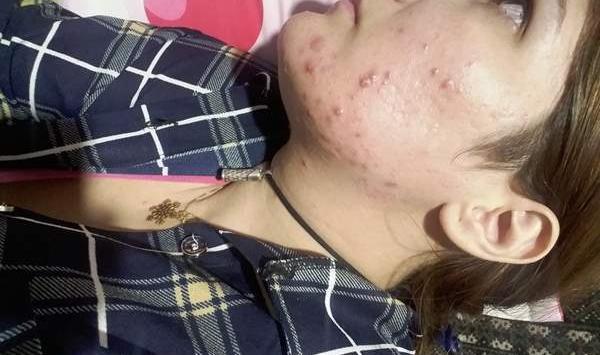 عکس صورتم نی نی سایت