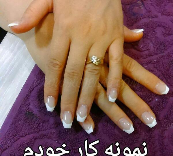 عکس کاشت فرنچ