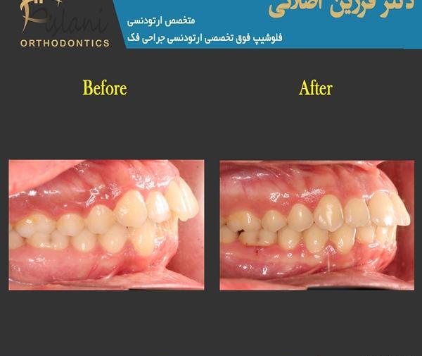 عکس سه بعدی فک