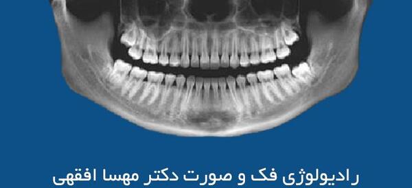 عکس سه بعدی فک