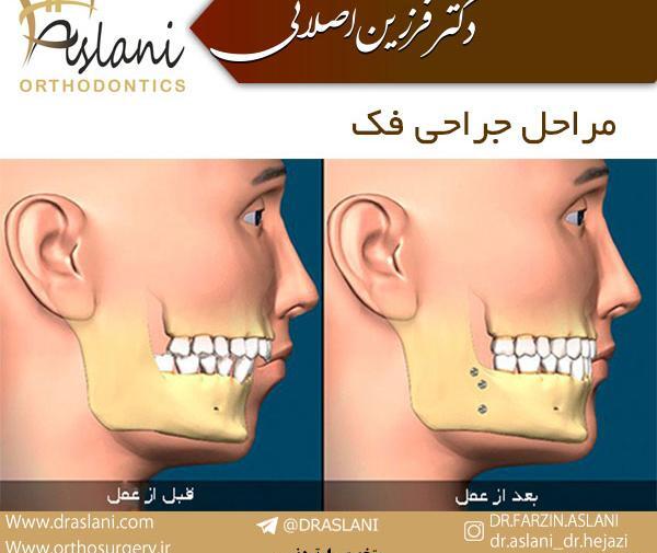 عکس سه بعدی فک