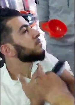عکس ریش کراتینه