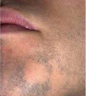 عکس قارچ ریش