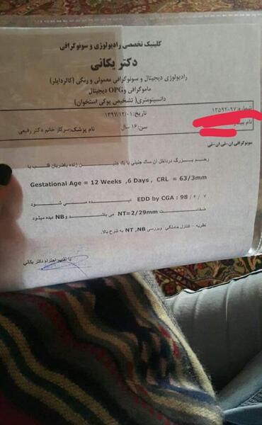 عکس غربالگری اول نی نی سایت