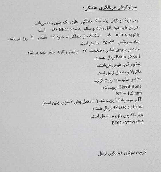 عکس غربالگری اول نی نی سایت