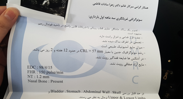 عکس غربالگری اول نی نی سایت