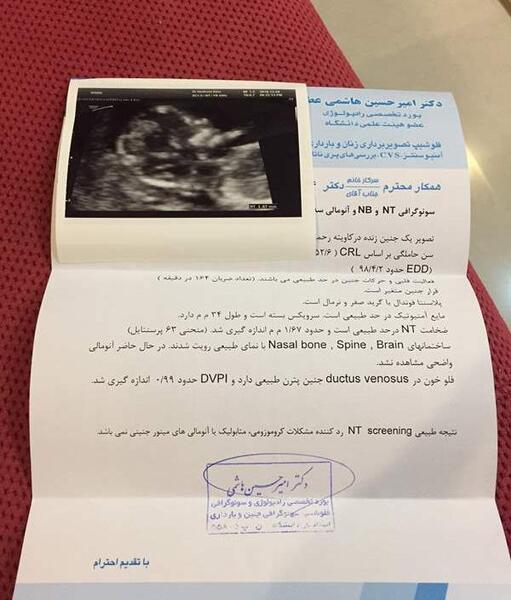 عکس غربالگری اول نی نی سایت