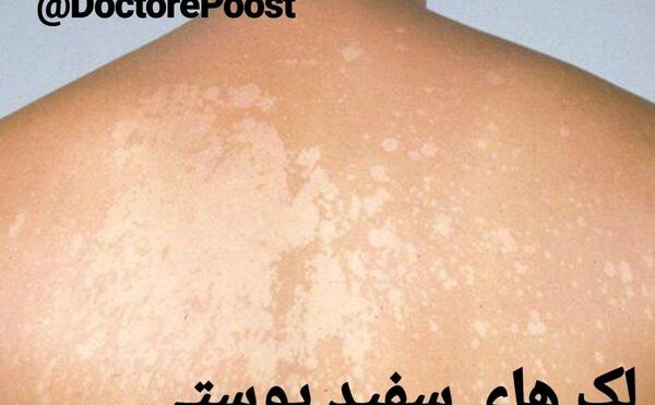 عکس لک سفید