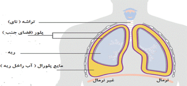 عکس ریه نرمال