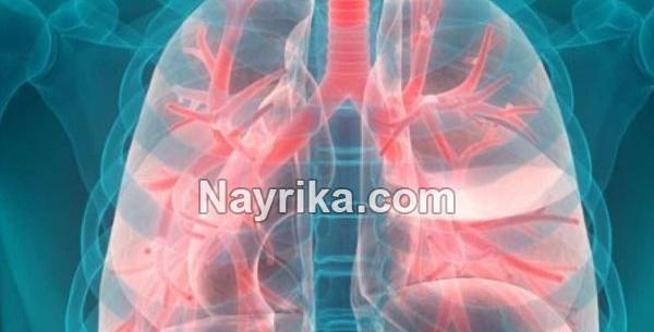 عکس سرطان ریه پیشرفته