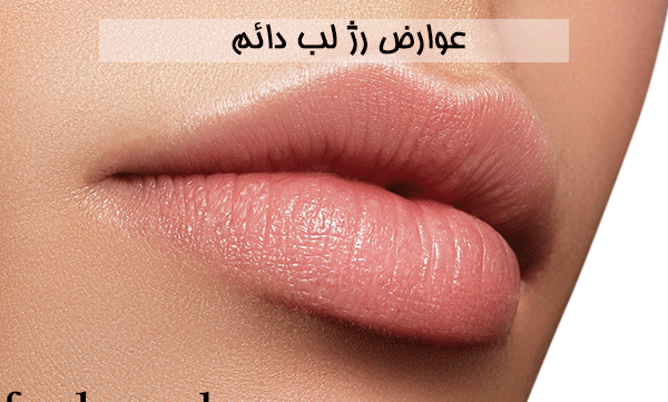 عکس کاشت رژلب