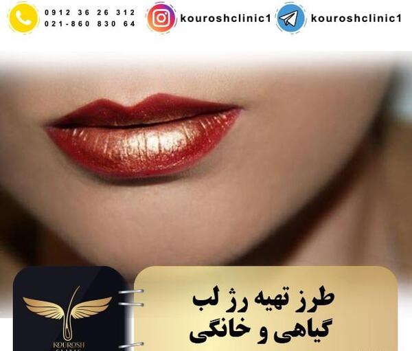 عکس کاشت رژلب