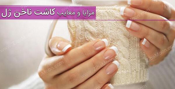 عکس کاشت ژل