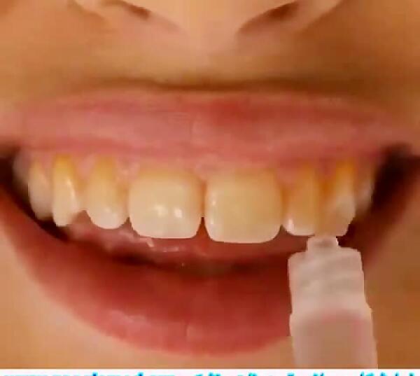 عکس ژل سفید کننده دندان